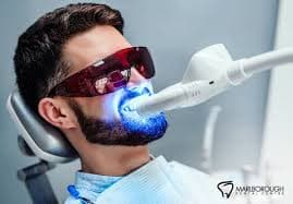 Teeth Whitening Options in Orlando: At-Home vs In-Office (What Actually Works?)